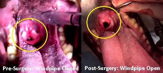 Larynx_Pre&PostSurg