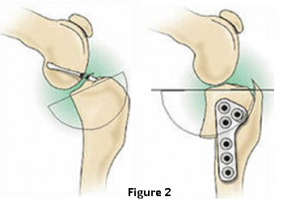 TPLO_Fig2